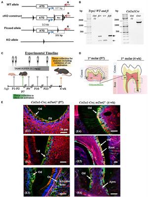 Deficiency of Mineralization-Regulating Transcription Factor Trps1 Compromises Quality of Dental Tissues and Increases Susceptibility to Dental Caries
